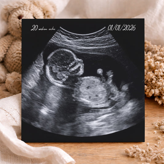 Geboorte Tegel - Echografie Afbeelding Gepersonaliseerd