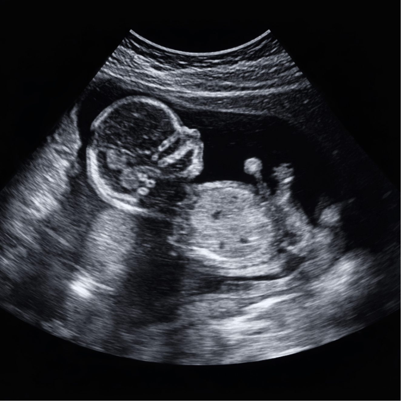 Geboorte Tegel - Echografie Afbeelding Gepersonaliseerd