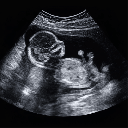 Geboorte Tegel - Echografie Afbeelding Gepersonaliseerd